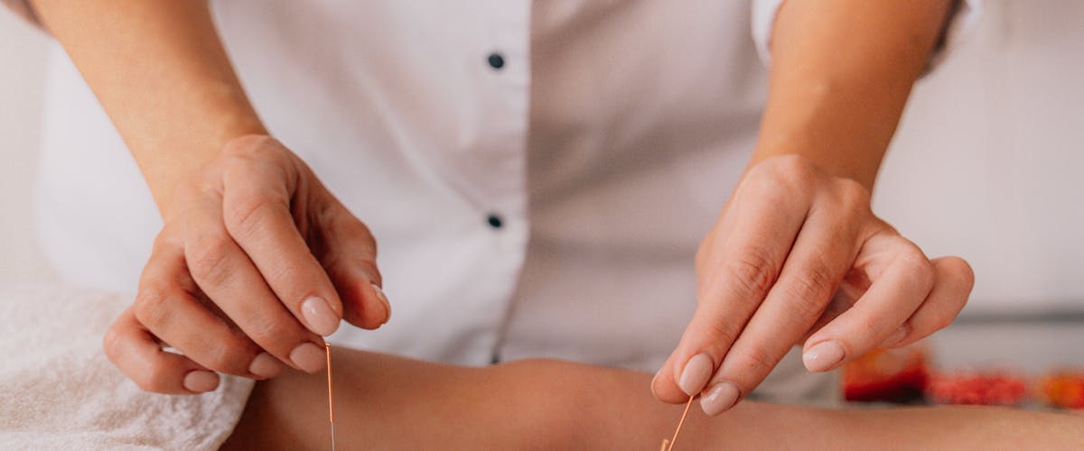 Acupunctuurbehandeling bij neuropathie en zenuwpijn in de knieën