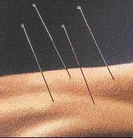 Acupuncture needles – fine needles on a calm surface
